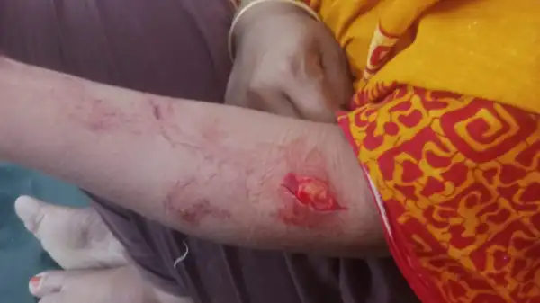 জীবননগরে স্বেচ্ছাসেবক দল নেতার স্ত্রীকে ধর্ষণ ও কুপিয়ে জখমের অভিযোগ