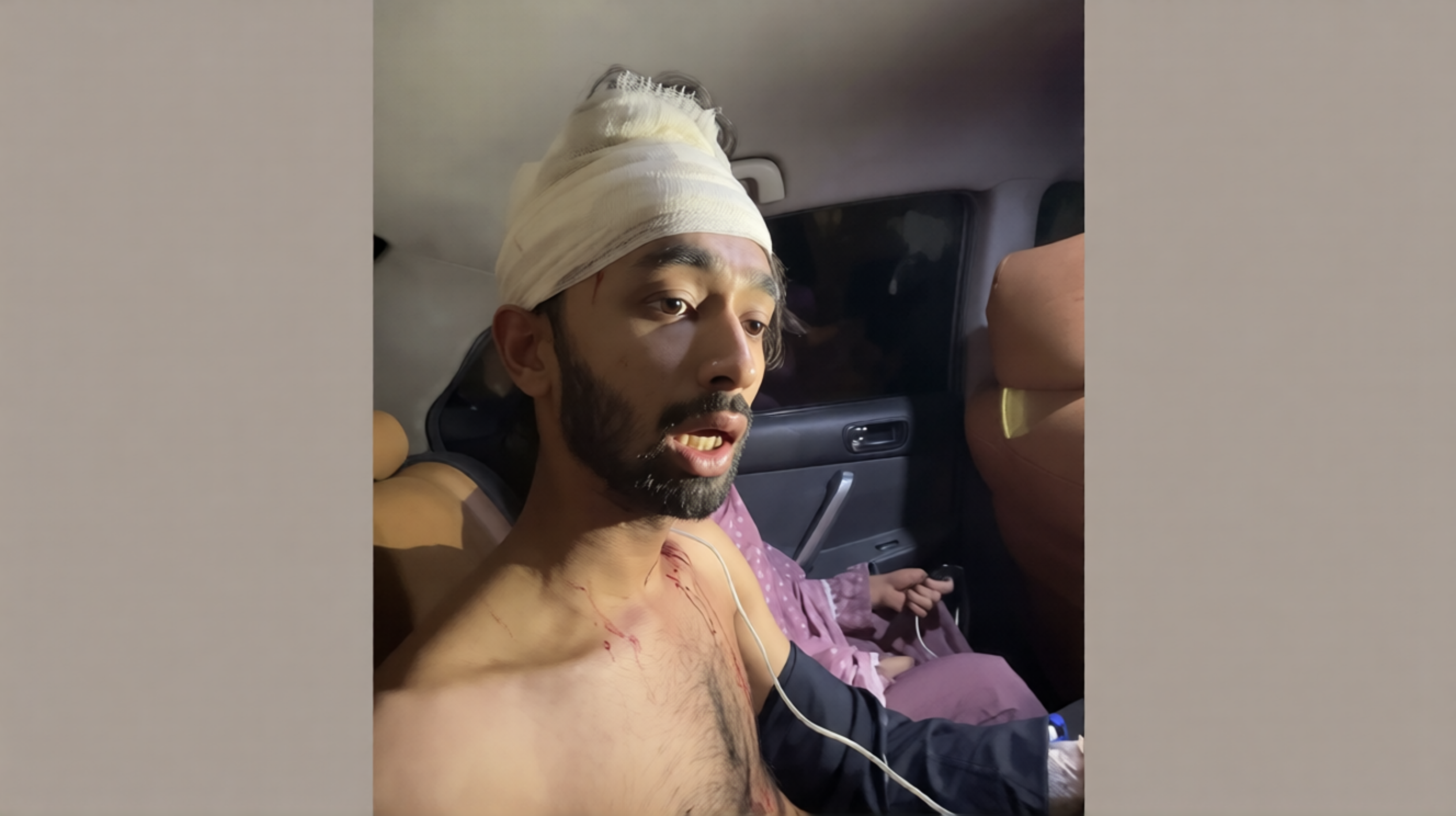 নোয়াখালীর চাটখিলে ছাত্রদল কর্মীকে কোপাল আ.লীগের নেতাকর্মীরা